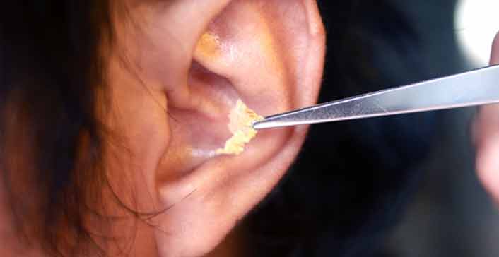How to Clean Wax Out Of Your Ear